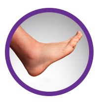 Swelling of hands, feet or throat